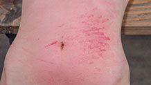 Flogger marks bruise Kay Kardia's stomach